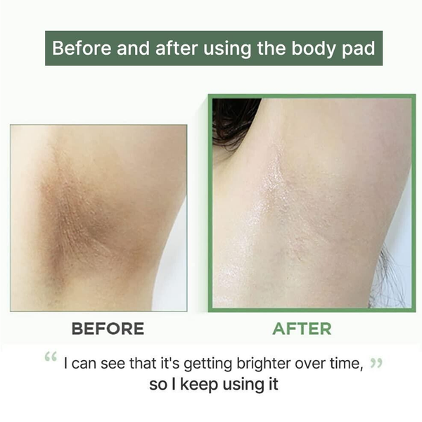 celimax JIWOOGAE One Step Body Brightening 60 Pad - detaliu textură K-Beauty | SkinCare Korea