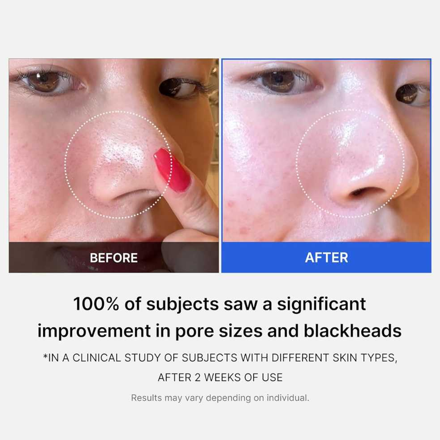 medicube Zero Pore Pad 2.0, 70pad - ingrediente și beneficii K-Beauty | SkinCare Korea